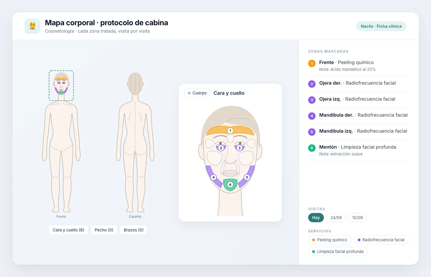 Zonas del rostro por sesión