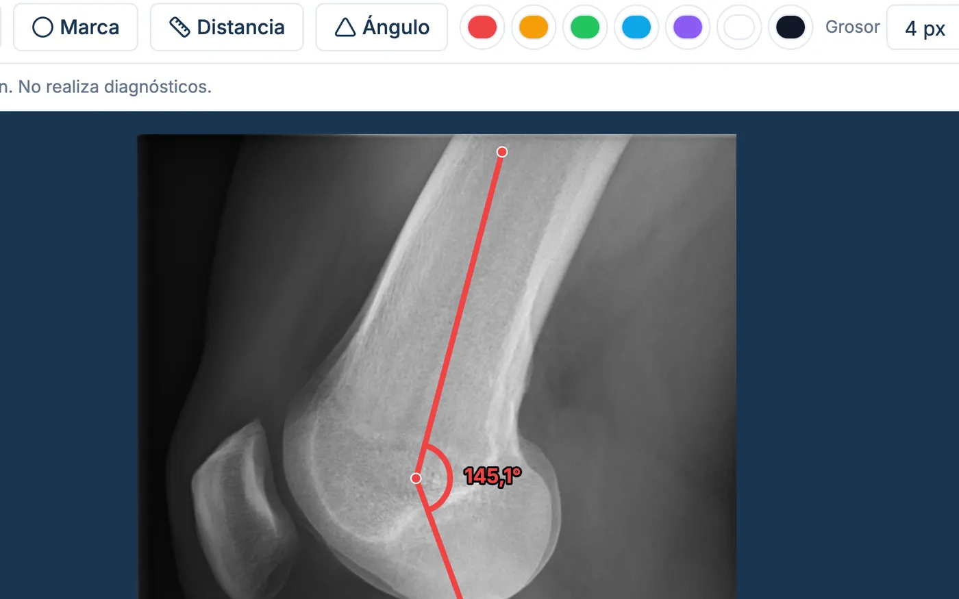 Radiografías con medidas