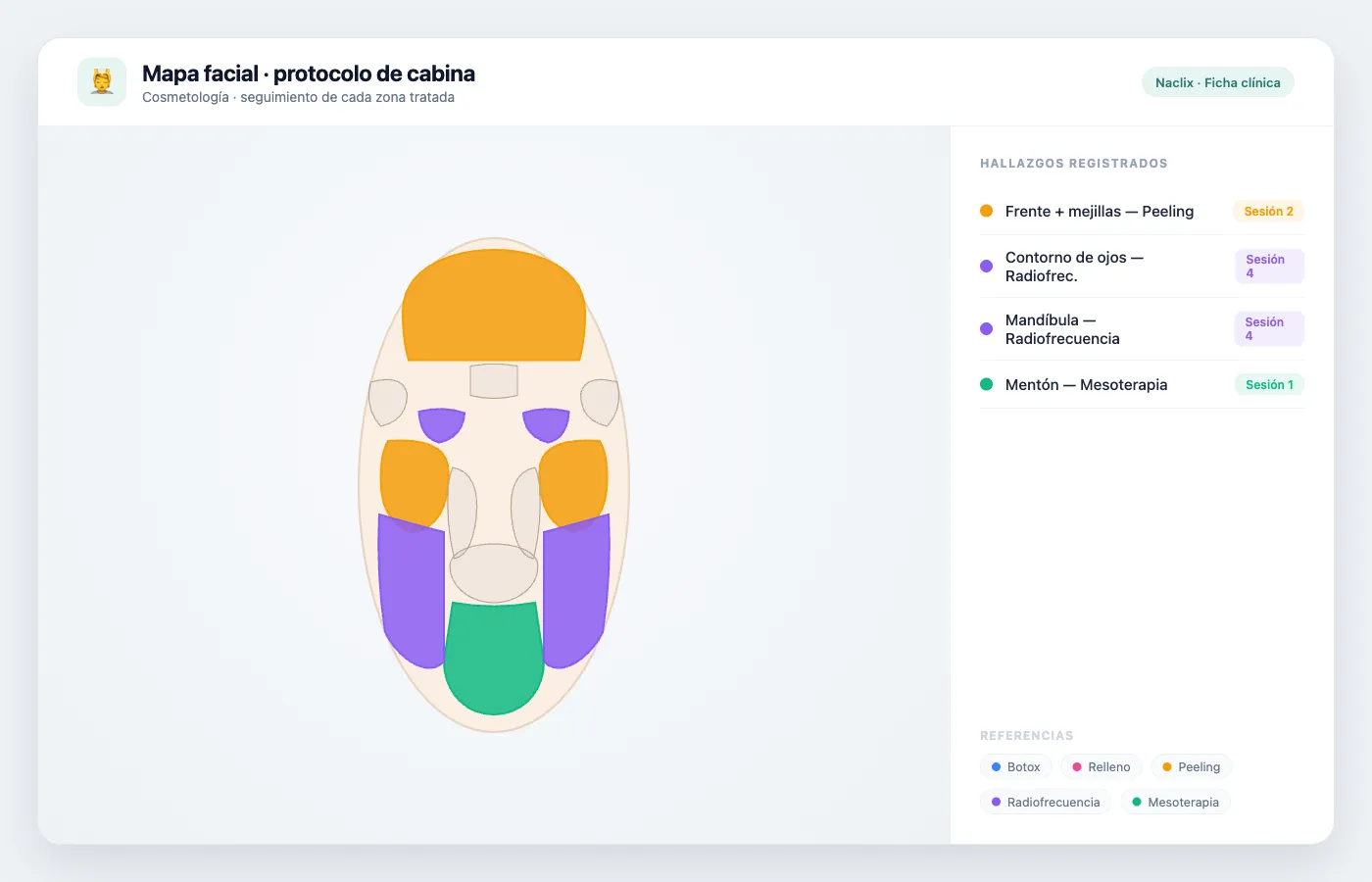 Mapa facial de cabina